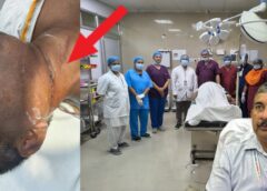 ठाकुरगंज संयुक्त चिकित्सालय में कैंसर मरीज को मिली नई जिंदगी, 40 वर्षीय मरीज जीभ के किनारे बने घाव से परेशान था