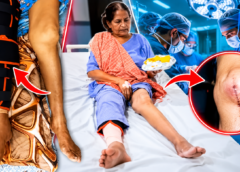 बाएं घुटने का होना था ऑपरेशन, डॉक्टर ने कर दिया दाहिने का! लखनऊ में 70 वर्षीय महिला के परिजनों का गंभीर आरोप