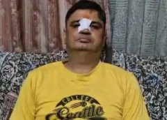 लखनऊ में चीनी मांझे का कहर: हाईकोर्ट के वकील की नाक कटी, ढाई इंच का घाव और 3 टांके